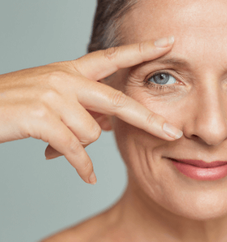 Blepharoplasty or Eye Lift