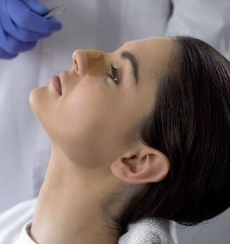Rhinoplasty