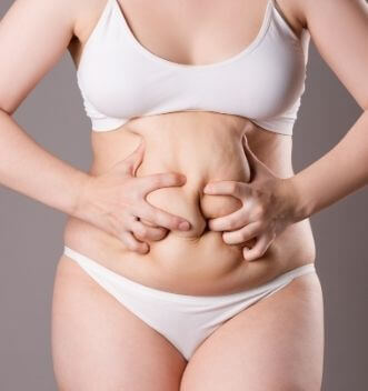 Tummy Tuck before
