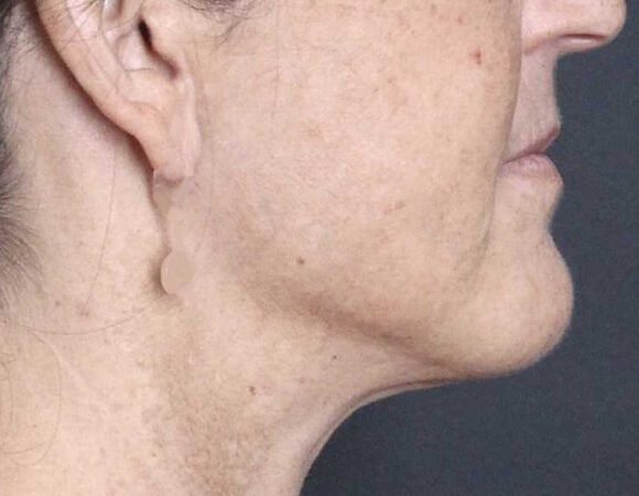 Gallery thumbnail 10