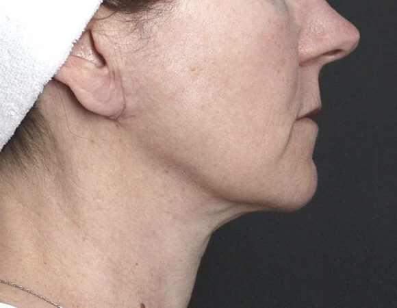 Gallery thumbnail 12