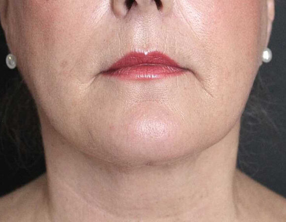 Gallery thumbnail 11