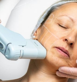 Non-invasive Skin Tightening