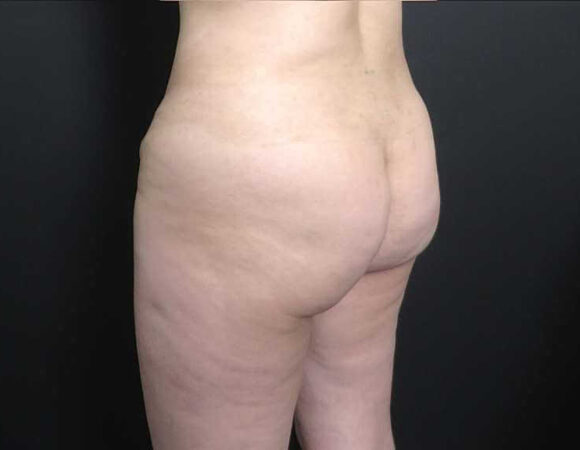 Gallery thumbnail 10