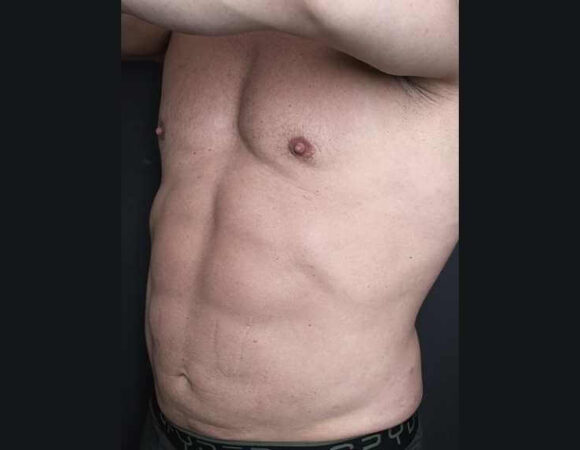 Gallery thumbnail 14