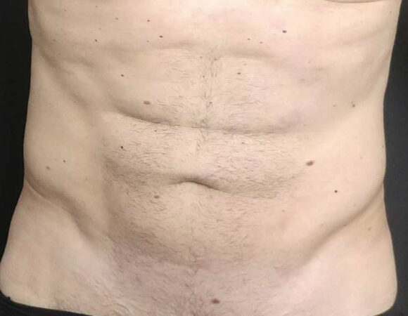 Gallery thumbnail 16