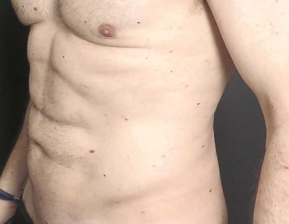 Gallery thumbnail 17