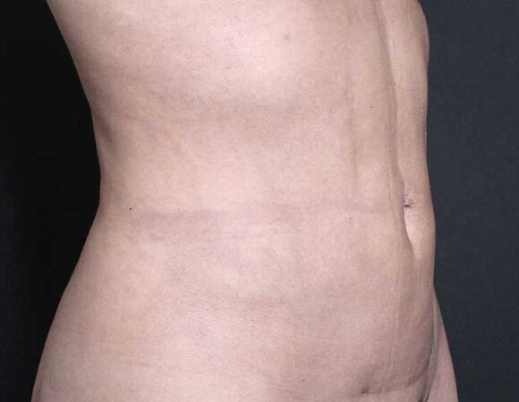 Gallery thumbnail 11