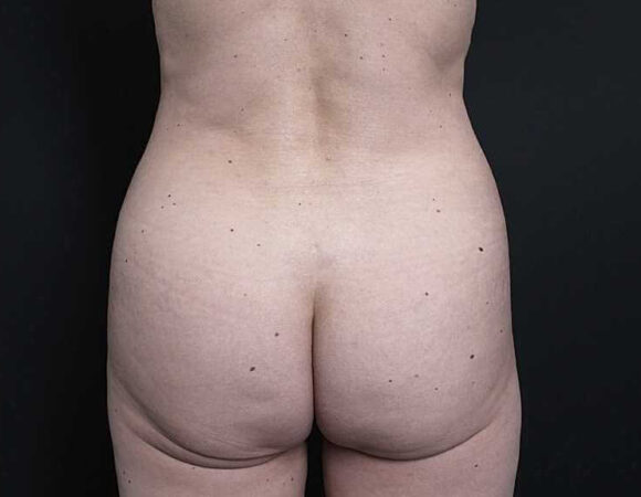 Gallery thumbnail 15