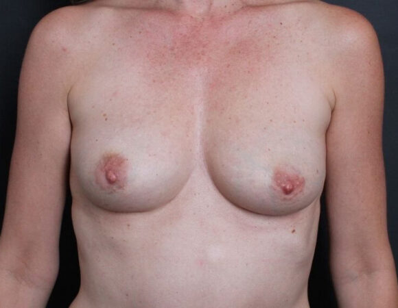 Gallery thumbnail 12