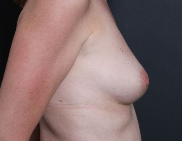 Gallery thumbnail 13