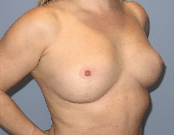 Gallery thumbnail 13