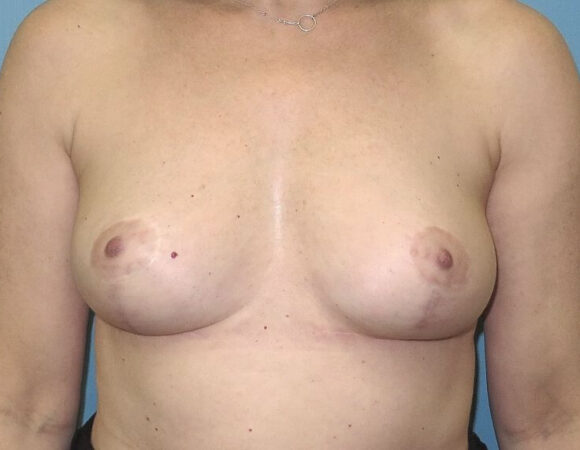 Gallery thumbnail 14