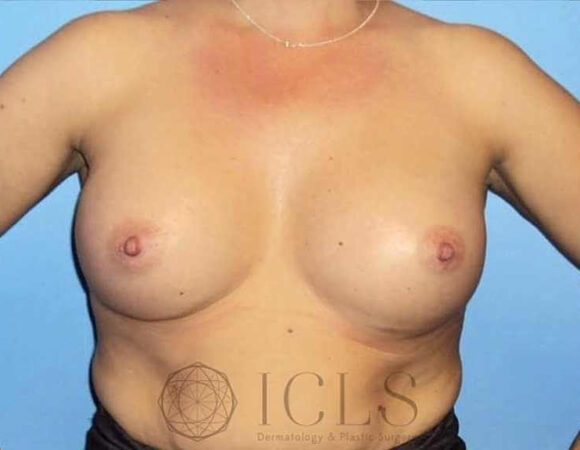 Gallery thumbnail 11