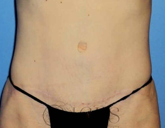 Gallery thumbnail 17