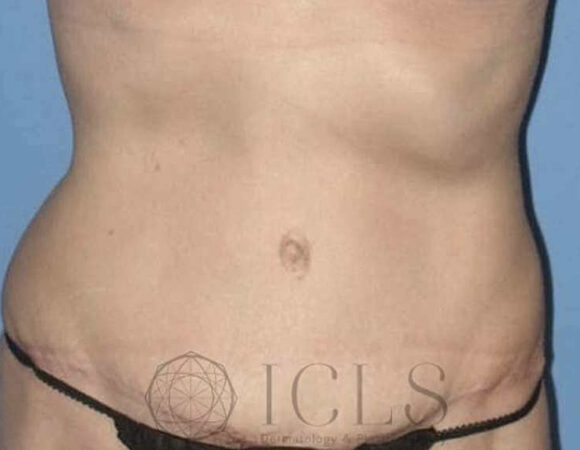 Gallery thumbnail 10