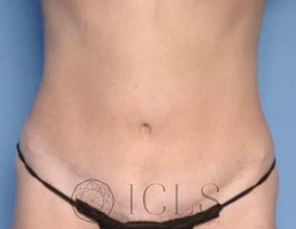 Gallery thumbnail 11