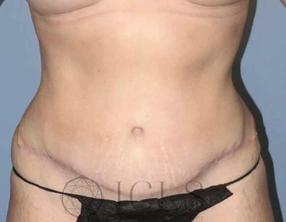 Gallery thumbnail 12