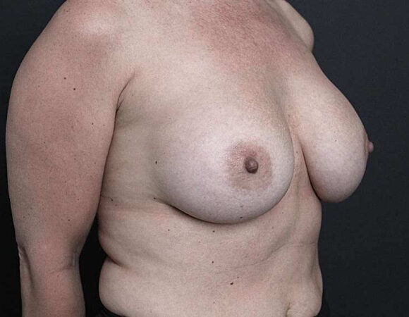 Gallery thumbnail 11