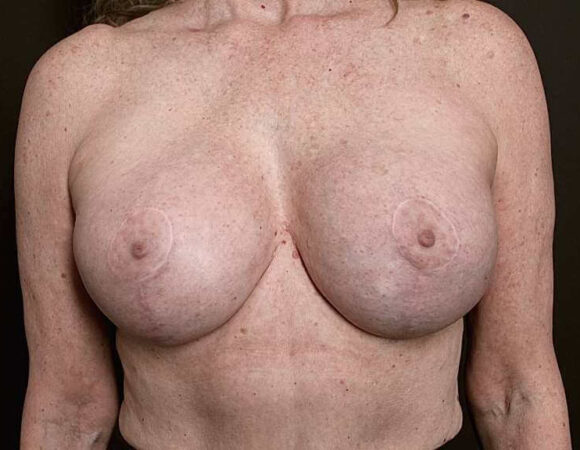 Gallery thumbnail 15