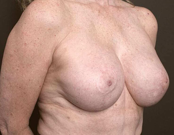 Gallery thumbnail 12