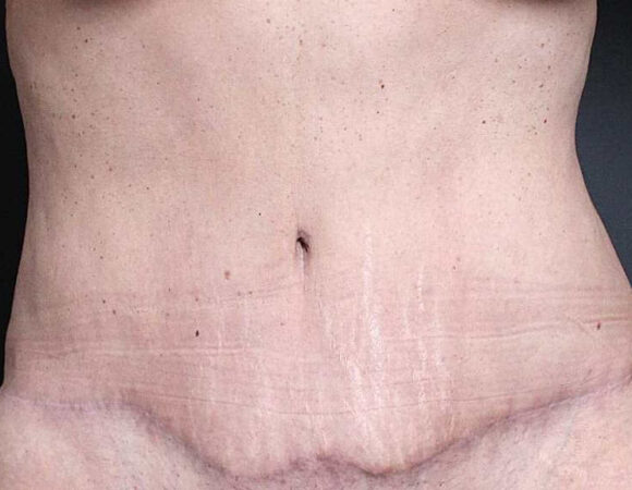 Gallery thumbnail 15