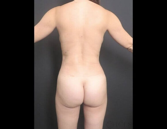 Gallery thumbnail 13