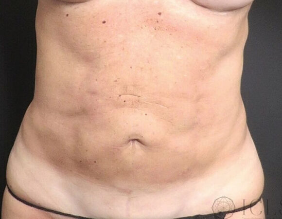 Gallery thumbnail 21