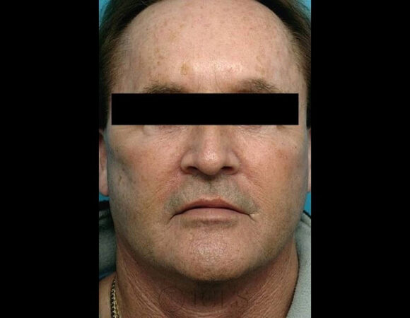 Gallery thumbnail 15