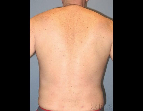 Gallery thumbnail 23