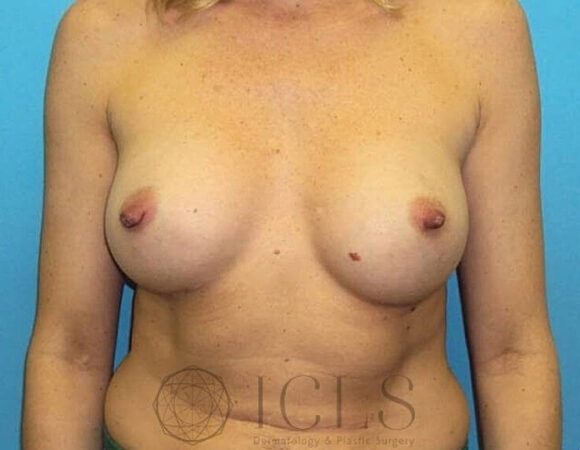 Gallery thumbnail 13