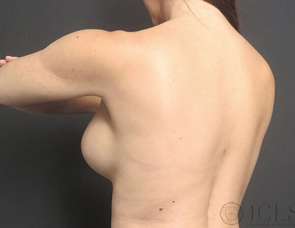 Gallery thumbnail 12