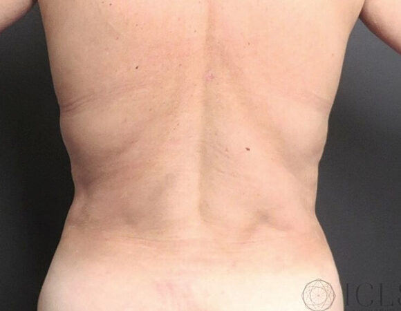 Gallery thumbnail 20