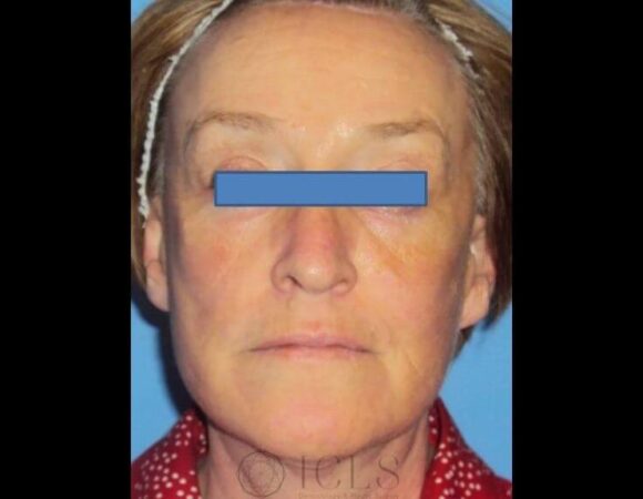 Gallery thumbnail 11