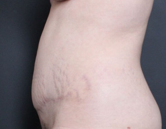 Gallery thumbnail 18