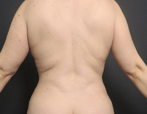 Gallery thumbnail 24