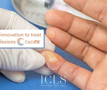 ICLS and CellFX