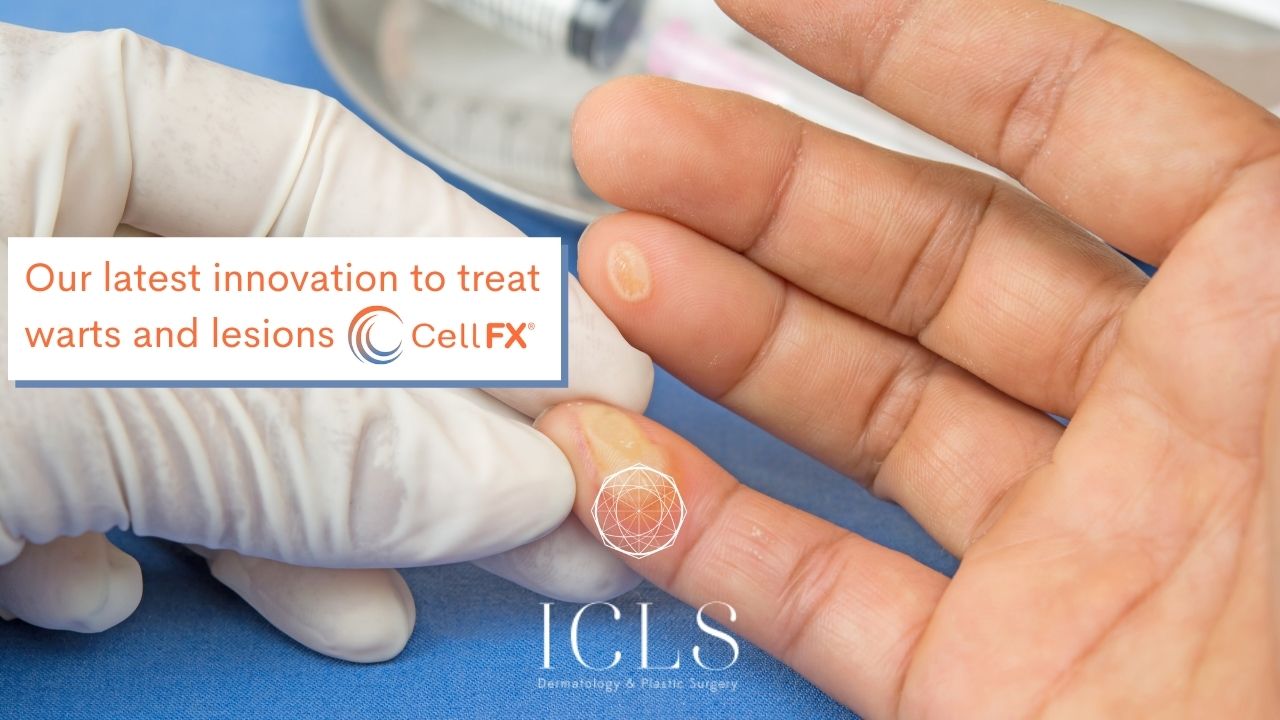 ICLS and CellFX