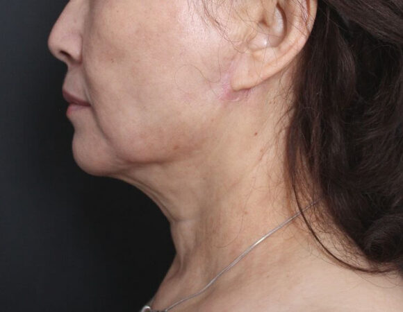 Gallery thumbnail 13