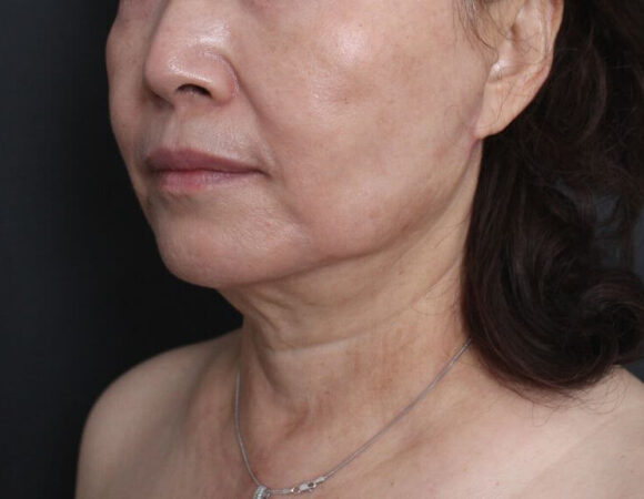 Gallery thumbnail 14