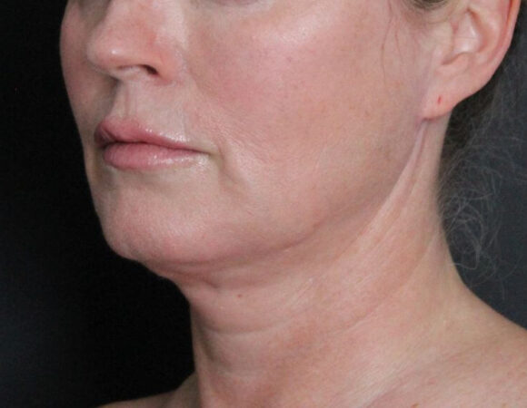 Gallery thumbnail 16