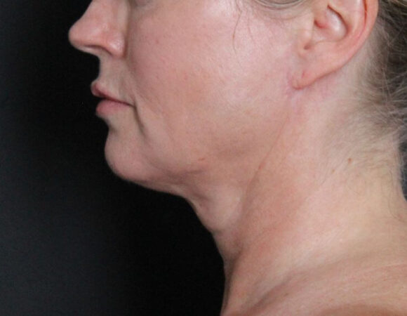 Gallery thumbnail 18