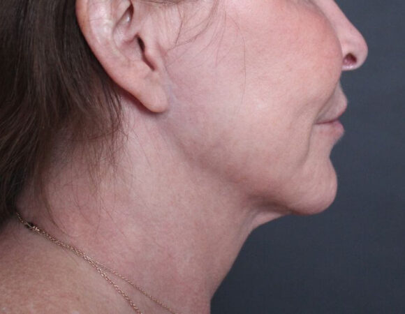 Gallery thumbnail 20