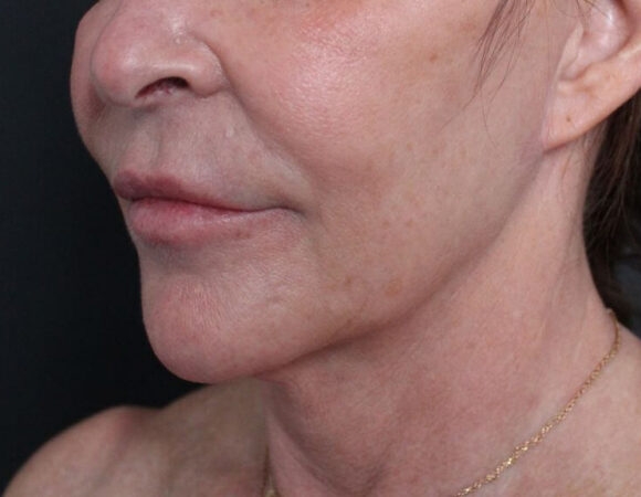 Gallery thumbnail 21