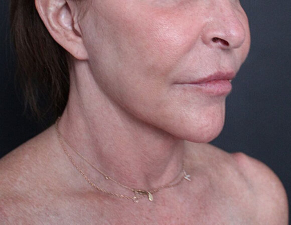 Gallery thumbnail 22