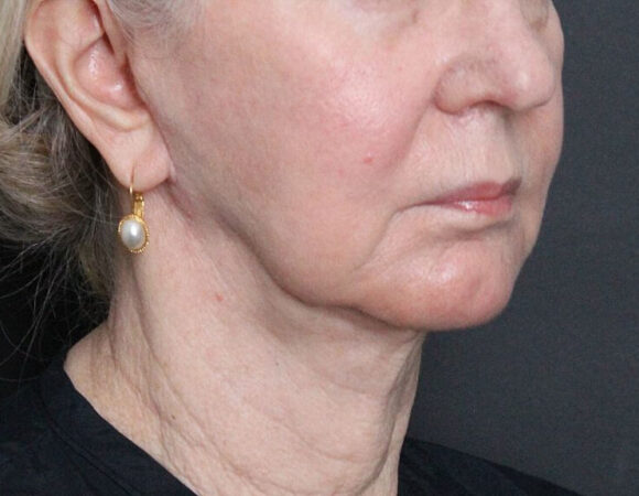 Gallery thumbnail 19