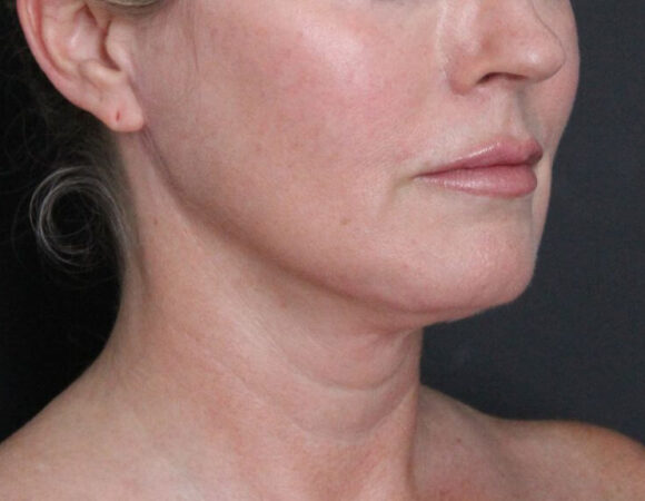 Gallery thumbnail 15