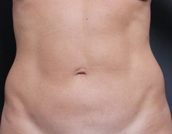 Gallery thumbnail 34