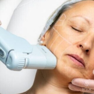 ultherapy device